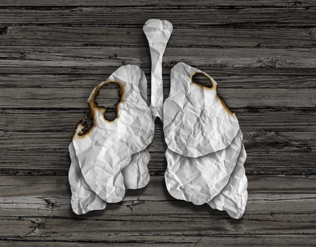 Cancer du poumon : comment se soigner naturellement ?