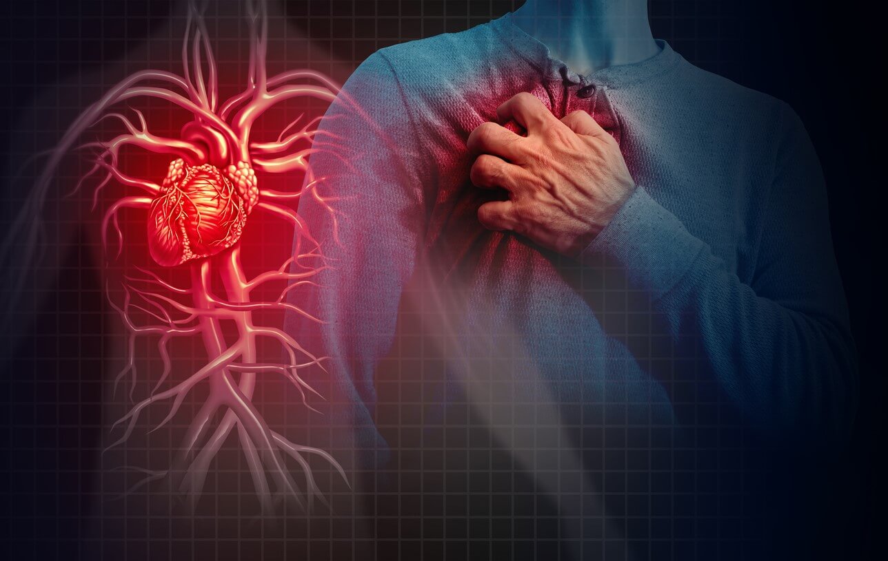 Quels sont les effets de l’infarctus du myocarde
