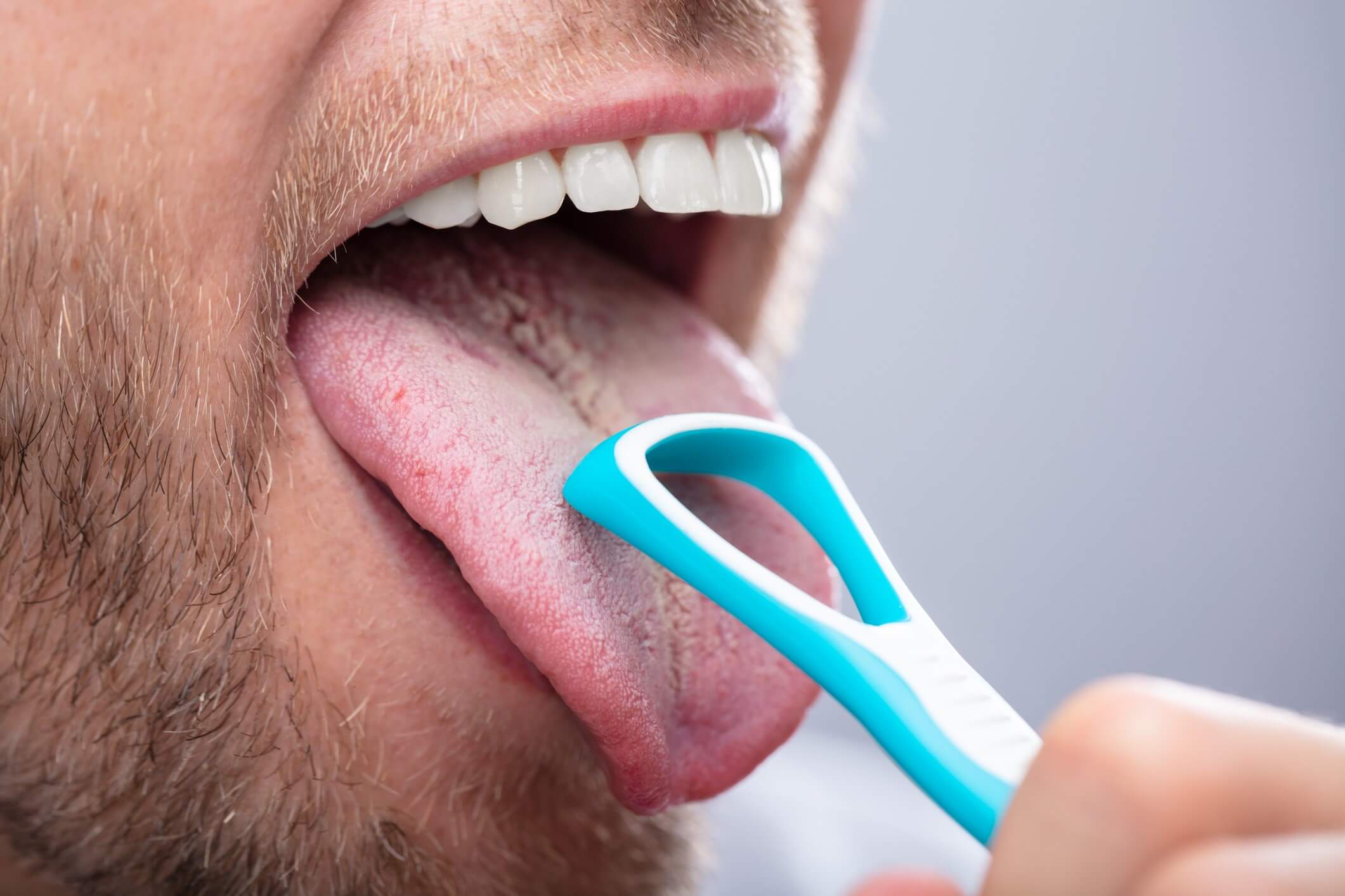 Langue chargée: comment la nettoyer? - Stress.app