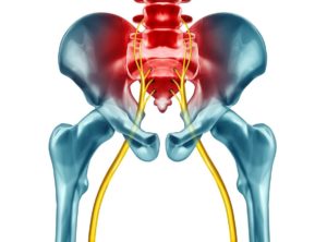 Nerf sciatique : comment le débloquer ?