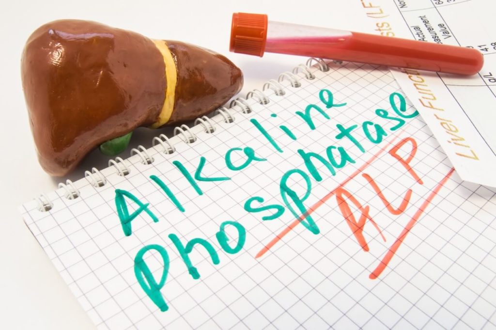 Phosphatase alcaline élevée : comment la diminuer ?