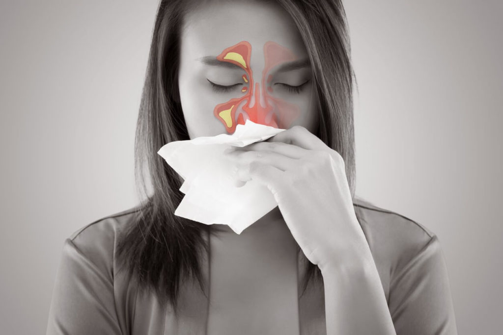 Sinusite: comment se soigner naturellement?