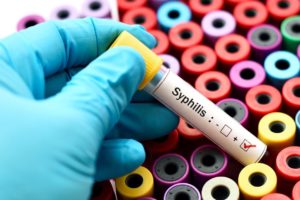 Syphilis: comment se protéger de cette IST?