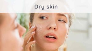 Dry skin: how to moisturize it naturally?